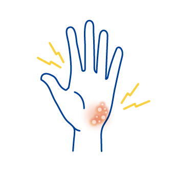 掌蹠膿疱症アイコン
