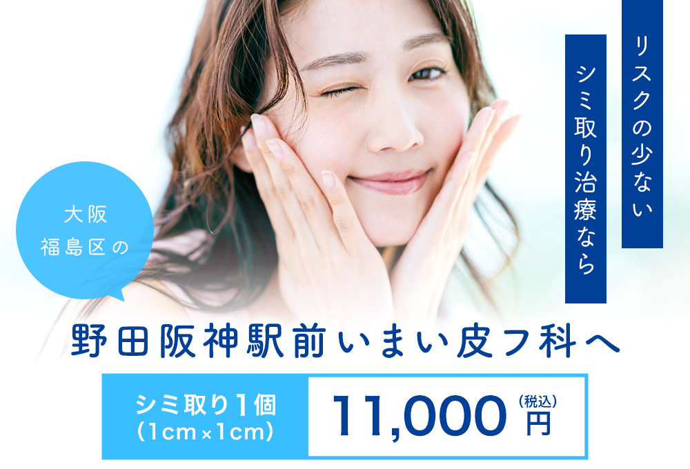リスクの少ないシミ取り治療なら野田阪神駅前いまい皮フ科へ シミ取り1個(1cm×1cm)11,000円
