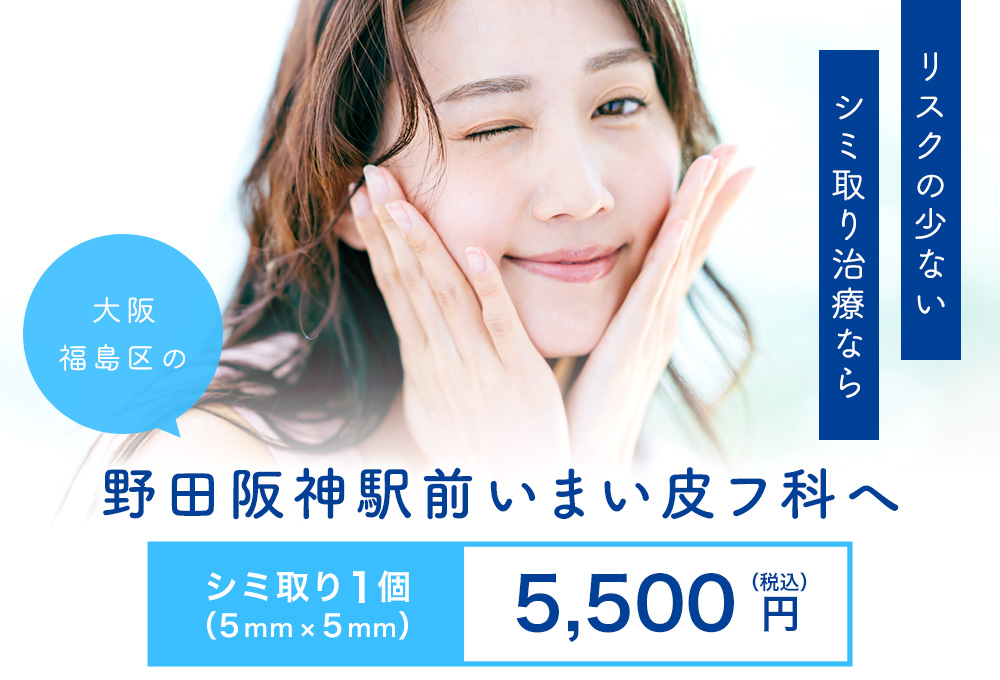 リスクの少ないシミ取り治療なら野田阪神駅前いまい皮フ科へ　シミ取り1個（5mm×5mm）5,500円
