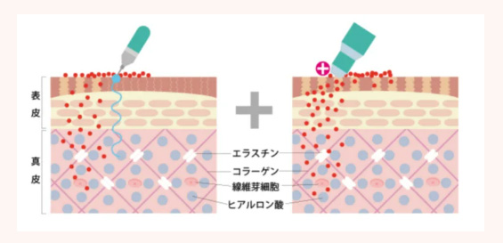 メソナJはこんな方におすすめ　イメージ
