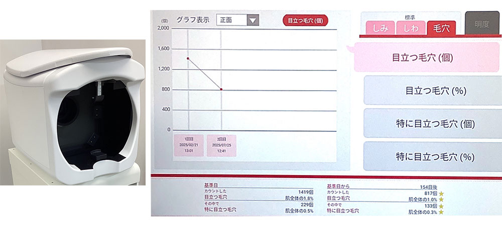 画像解析機レビュー2